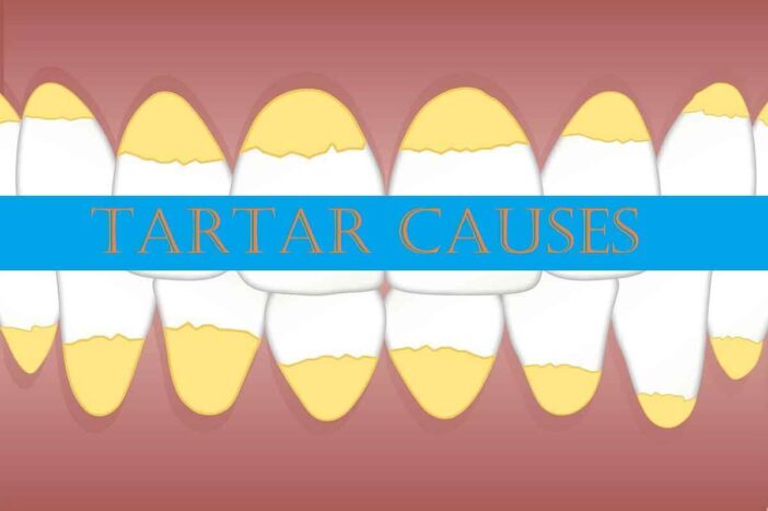 What Causes Tartar Buildup On Your Teeth