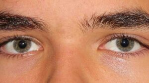 What is Diplopia?  Marc Marquez’s Eye Nerve Paralyzed During The Mandalika MotoGP