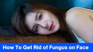 How To Get Rid of Fungus on Face