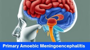Primary Amoebic Meningoencephalitis