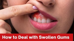 How to Deal with Swollen Gums